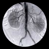 Arterie